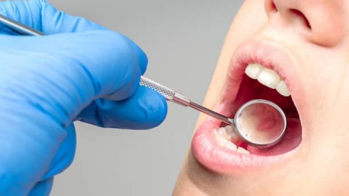 SEP: 86% de escuelas prohíben comida chatarra; pero 76% de niños padecen caries