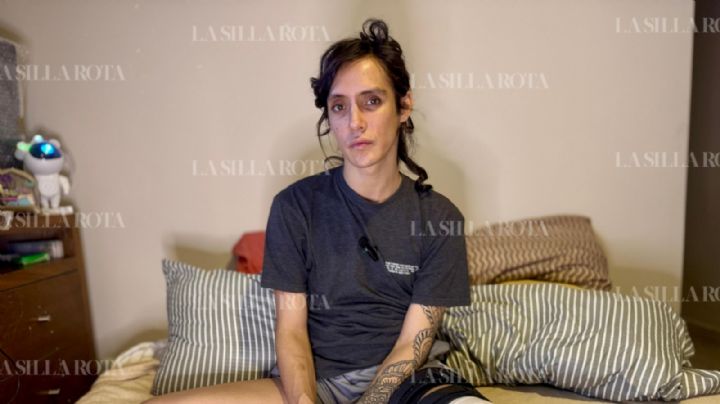 “Pedí Uber Moto, me rompió la rodilla y el conductor huyó”: los mototaxis que operan fuera de la ley en CDMX