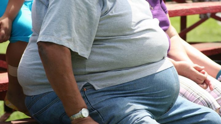 Obesidad afecta principalmente a mujeres en Hidalgo: suman más del 70 % de los casos