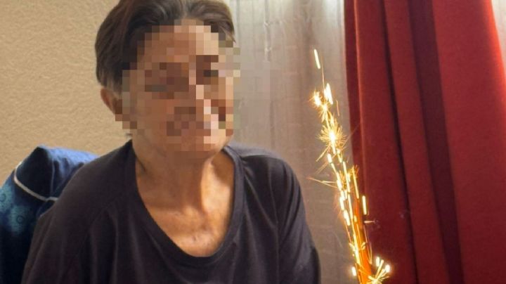 IMSS C. Izcalli: paciente con dolor abdominal recibe pase a cirugía por hernia, Elba tiene cáncer