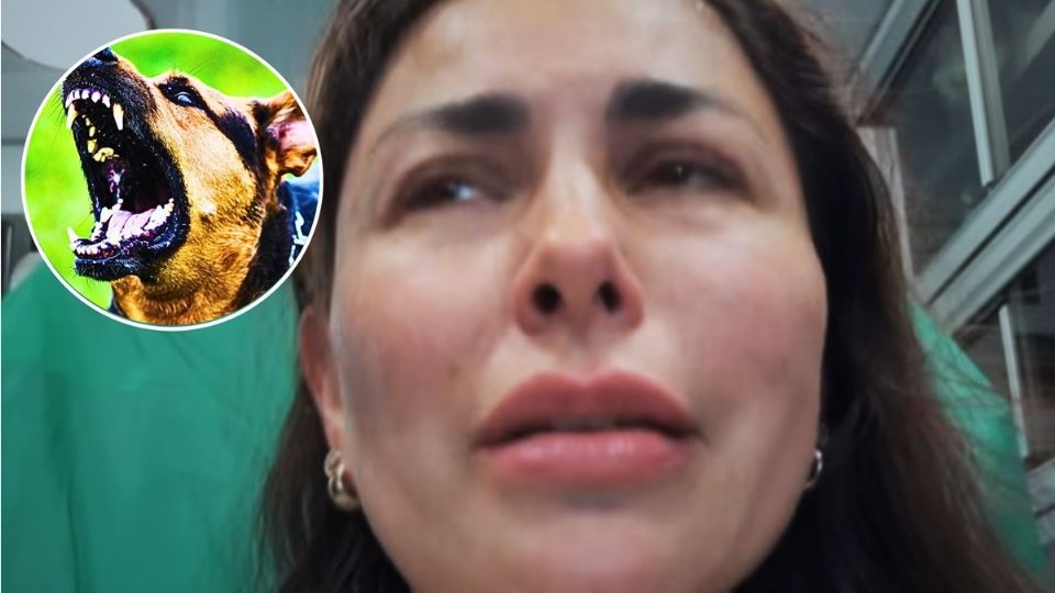 Su experiencia tras ser mordida por un perro