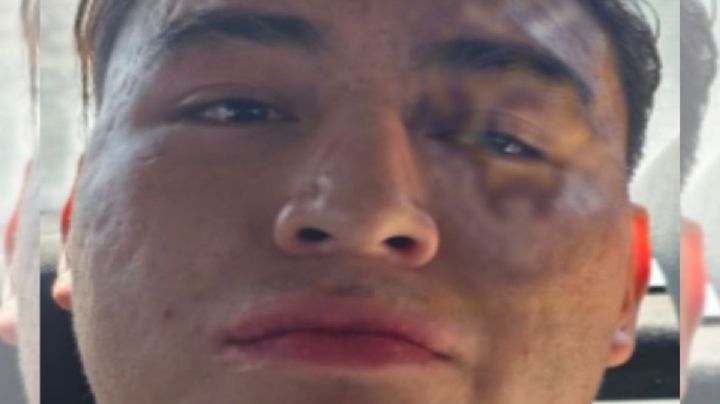 Acuchilla a su novia porque no quiso seguir la fiesta; lo detienen en Tláhuac