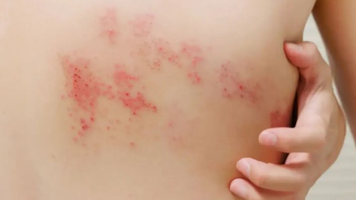 La vacuna esencial para adultos mayores de 50