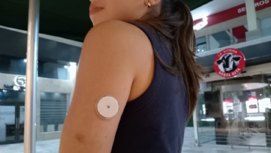 No es por mi peso ni por mi alimentación: Milca vive con diabetes tipo 1 su adolescencia