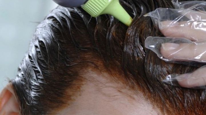 ¿Te tiñes el cabello? Descubre cómo eliminar fácilmente el tinte de la piel sin dañarla