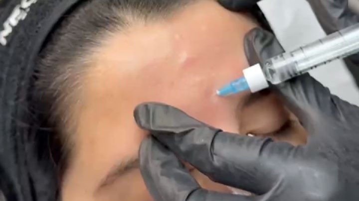 Riesgos y falsas promesas en las terapias “para no envejecer”