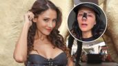 Foto ilustrativa de la nota titulada: ¿Quién es Dorismar, la actriz de Televisa que quedó desfigurada tras someterse a una cirugía estética?
