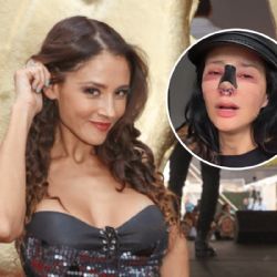 ¿Quién es Dorismar, la actriz de Televisa que quedó desfigurada tras someterse a una cirugía estética?