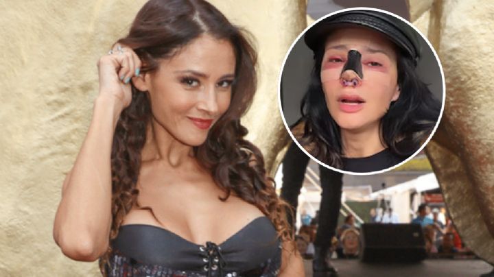 ¿Quién es Dorismar, la actriz de Televisa que quedó desfigurada tras someterse a una cirugía estética?