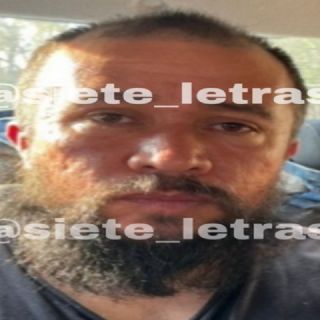 Golpeó con un martillo a su vecina en CDMX: así ocurrió el ataque que casi termina en feminicidio