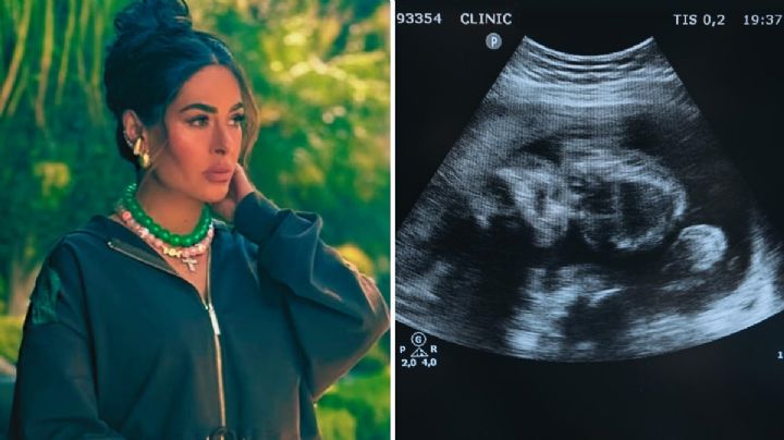 Galilea Montijo se hace ultrasonido en vivo en Televisa para ver si está embarazada