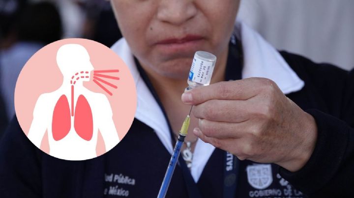 Vacuna contra la tos ferina en Xalapa: edad y requisitos