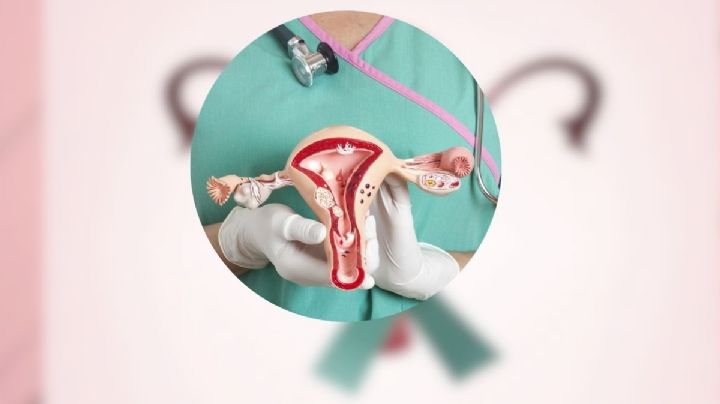 Información, clave para autocuidado y detección temprana de cáncer cervicouterino