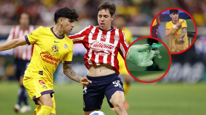 La polémica noticia que recibió América tras la agresión a Kevin Álvarez