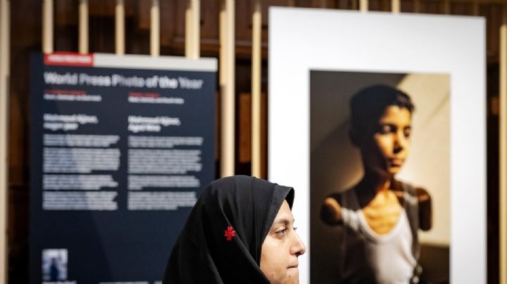 Fotógrafa palestina gana World Press Photo por imagen de niño mutilado