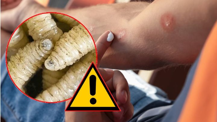 Salud confirma primer caso de miasis por gusano barrenador en México