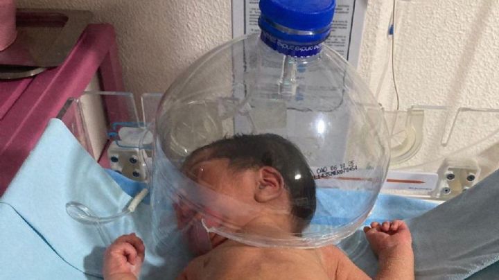 Indignación en Tabasco: atienden a bebé con botella de plástico en IMSS-Bienestar