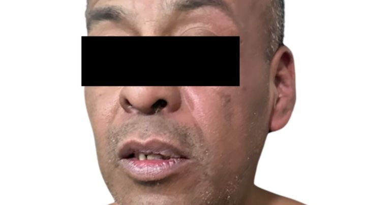 Capturan al "Pancho Loco", autor material del asesinato del exdiputado Paco Rojas en Edomex