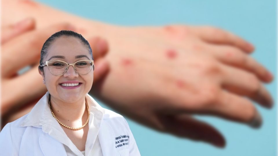 La Secretaría de Salud implementó un cerco sanitario para evitar la propagación de la enfermedad