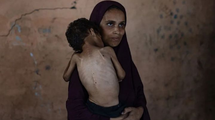 Morir de hambre en Gaza: miles de niños luchan por sobrevivir sin alimento ni medicinas