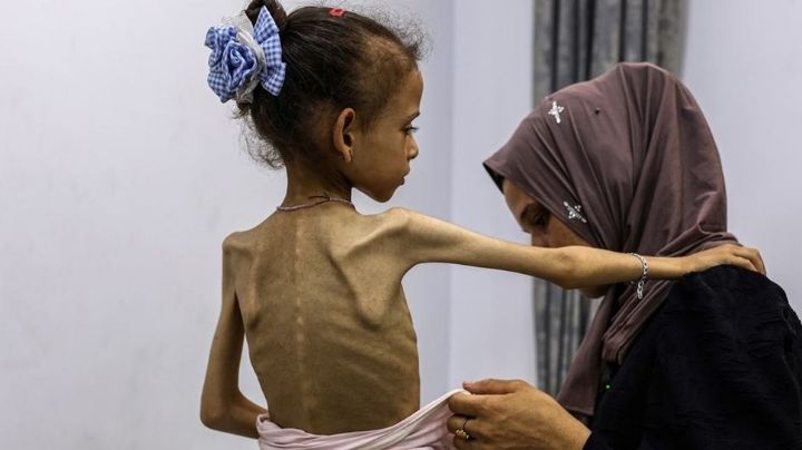 Hambre global en aumento: expertos alertan sobre sus consecuencias geopolíticas