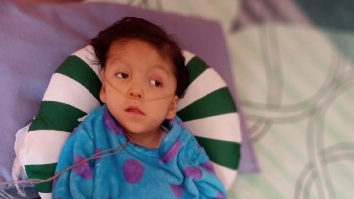 Liam tiene 3 años de edad, tiene síndrome de west y necesita ayuda