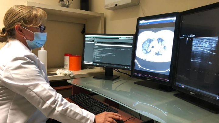 Miomas uterinos en mujeres mexicanas: causas, síntomas y tratamiento