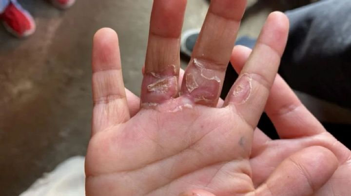 Quemaduras y golpes: La pesadilla de dos niños en el Estado de México