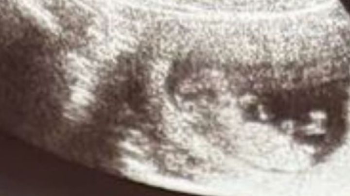 Kenya de 16 años será madre de un bebé sietemesino, por su edad su embarazo ha sido de alto riesgo