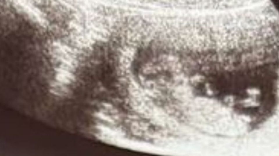 Ante este panorama el gobierno de Guanajuato diseñó un modelo de educación sexual que tiene como objetivo reducir el embarazo adolescente en el Estado