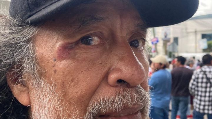 Corresponsal de La Jornada en Guerrero fue golpeado por empleado de la Presidencia de la República