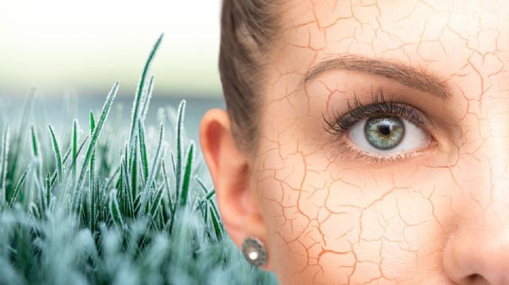 ¿Está dañando el frío mi piel? Estos son los síntomas y cómo prevenir los efectos