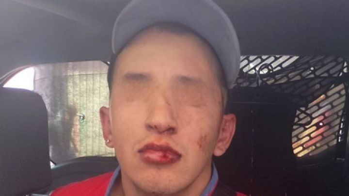 Magdalena Contreras: hombre mata a dos perros y luego al dueño por reclamarle