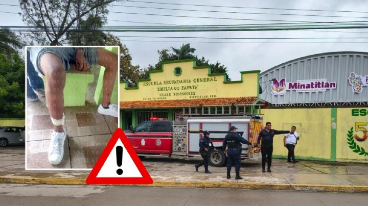 Perros pitbulls atacan a estudiantes en secundaria de Minatitlán; hay 7 lesionados