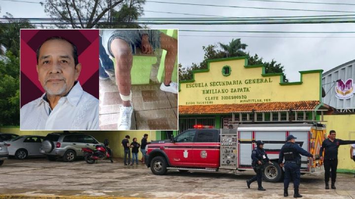 Se sancionará a dueño de pitbulls que atacaron a estudiantes en Minatitlán, afirma alcalde