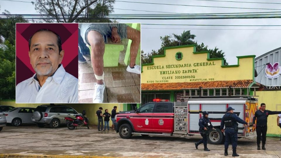 Vamor a sancionar al dueño: alcalde de Minatitlán tras ataque de pitbulls a 7 estudiantes