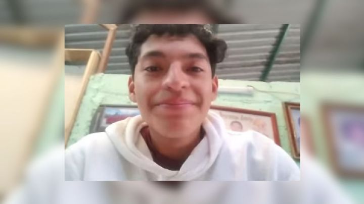 Jeyson, de Fortín, necesita una operación cerebral; pide apoyo para costear cirugía