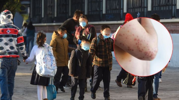 Sarampión Veracruz: escuelas de las Altas Montañas piden uso de cubrebocas por aumento de casos