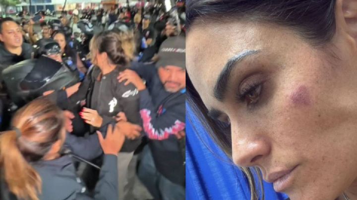 Alessandra Rojo de la Vega presenta 12 denuncias tras agresión en su contra: "pudo haber sido una tragedia"