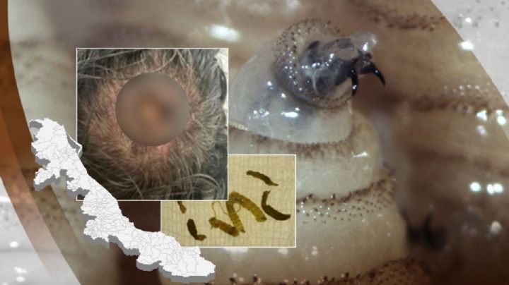 Confirman 8 casos de gusano barrenador en humanos en Veracruz; estos son los municipios