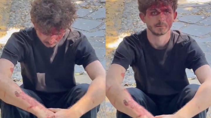 Agreden a fotógrafo italiano en funeral del “Mencho” en Zapopan | VIDEO