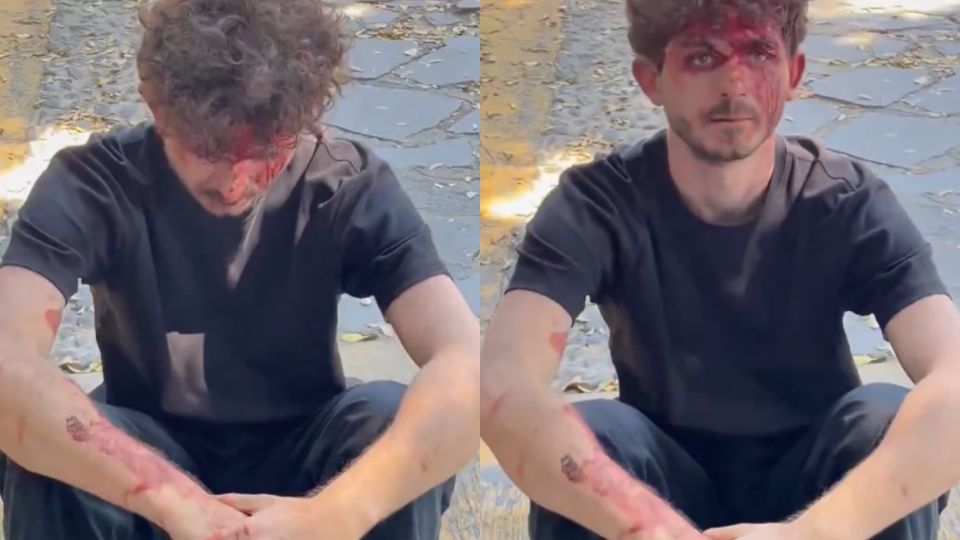 De acuerdo con un video difundido en redes sociales, el estudiante aparece con lesiones visibles en el rostro y sangrado tras la presunta golpiza