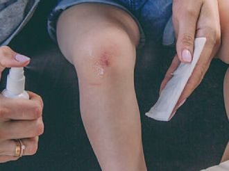 Innovación médica: spray detiene hemorragias en segundos y salva vidas