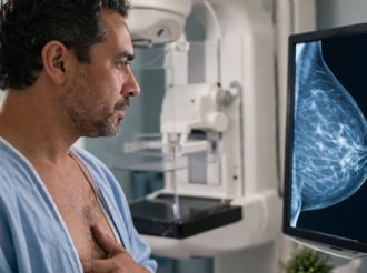 “Me hice una mastografía”: el caso que rompe el silencio en hombres