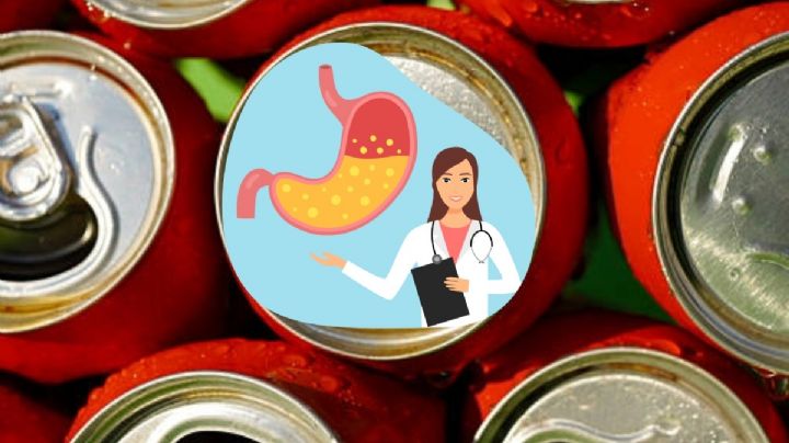 Consumo de refrescos light podría aumentar riesgo de cáncer de colon, advierte la UNAM