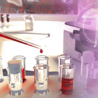 VIH entra en remisión tras trasplante: el caso que acerca la cura