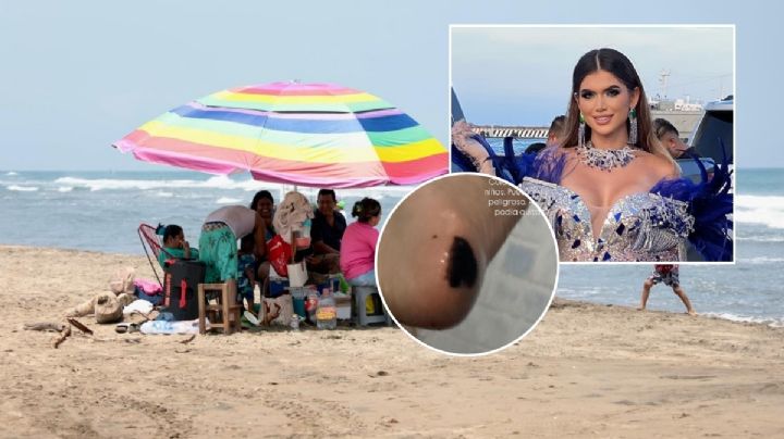Pisa chapopote en playa de Alvarado; influencer lo nota hasta llegar a casa