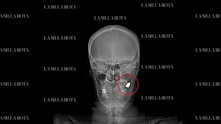 Balacera en Tepito deja a mujer con bala en el rostro; clínica no tenía especialista