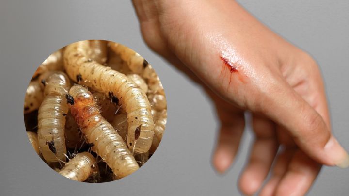 ¡Ojo con las heridas abiertas! Así debes cuidarte del gusano barrenador