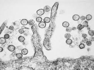 Síntomas del hantavirus: cómo identificarlo a tiempo